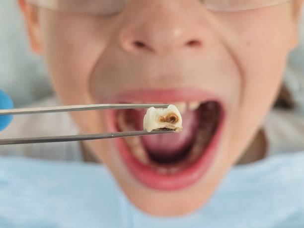 Best Same-Day Emergency Dentist in Tyrone, OK